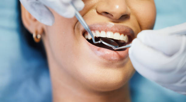 Best Same-Day Emergency Dental Services in New Bern, NC